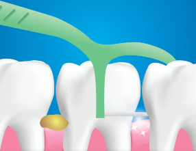 口腔問題可能要“命”！5大預(yù)警信號(hào)，別忽視