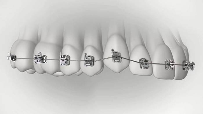 承德市哪家口腔醫(yī)院口腔正畸做得好？惟德口腔醫(yī)院來告訴您