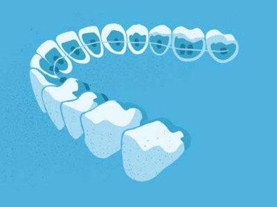 惟德口腔醫(yī)院口腔正畸好不好？